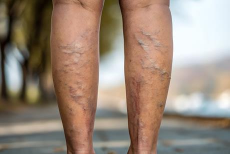 AdobeStock_1539163654